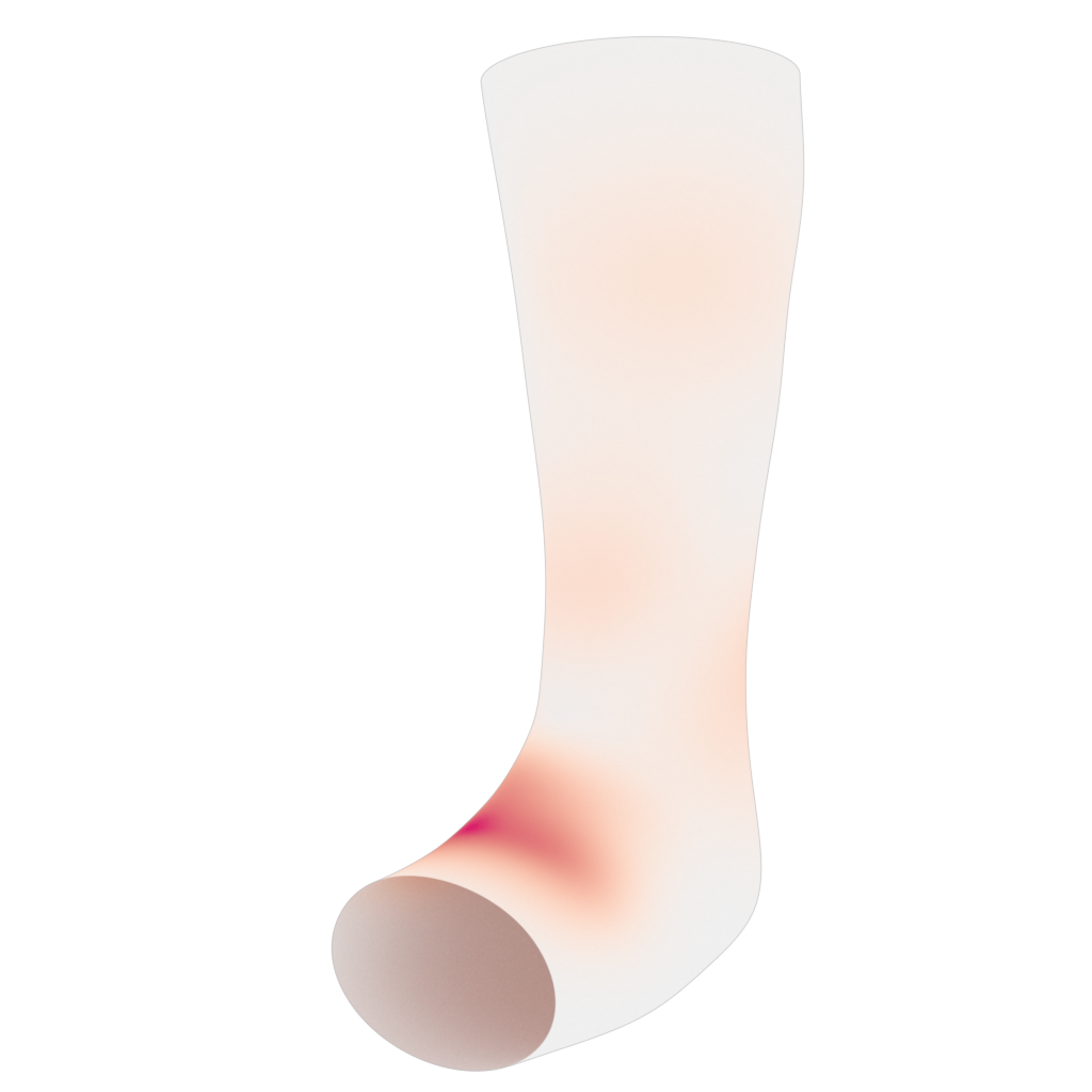 Hausdorff distance